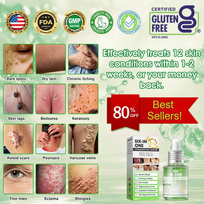 𝐎𝐫𝐢𝐚𝐜𝐡® 𝐀𝟏𝟎+ 𝟔-𝐢-𝐞𝐧 𝐃𝐞𝐫𝐦𝐚𝐑𝐞𝐩𝐚𝐢𝐫 𝐒𝐞𝐫𝐮𝐦 𝐅𝐃𝐀-𝐆𝐨𝐝𝐤𝐣𝐞𝐧𝐭 – Strammer opp slapp hud, reduserer blåmerker og senil purpura, og forbedrer keratinproduksjon, seboreisk dermatitt og follikulær keratose.