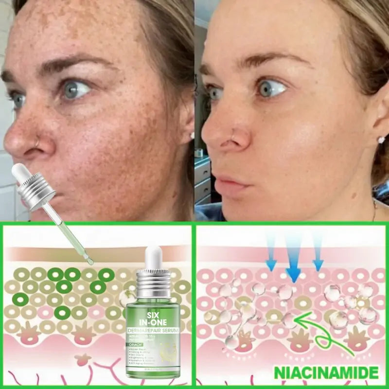 𝐎𝐫𝐢𝐚𝐜𝐡® 𝐀𝟏𝟎+ 𝟔-𝐢-𝐞𝐧 𝐃𝐞𝐫𝐦𝐚𝐑𝐞𝐩𝐚𝐢𝐫 𝐒𝐞𝐫𝐮𝐦 𝐅𝐃𝐀-𝐆𝐨𝐝𝐤𝐣𝐞𝐧𝐭 – Strammer opp slapp hud, reduserer blåmerker og senil purpura, og forbedrer keratinproduksjon, seboreisk dermatitt og follikulær keratose.