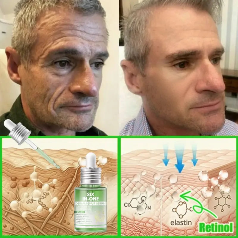 𝐎𝐫𝐢𝐚𝐜𝐡® 𝐀𝟏𝟎+ 𝟔-𝐢-𝐞𝐧 𝐃𝐞𝐫𝐦𝐚𝐑𝐞𝐩𝐚𝐢𝐫 𝐒𝐞𝐫𝐮𝐦 𝐅𝐃𝐀-𝐆𝐨𝐝𝐤𝐣𝐞𝐧𝐭 – Strammer opp slapp hud, reduserer blåmerker og senil purpura, og forbedrer keratinproduksjon, seboreisk dermatitt og follikulær keratose.