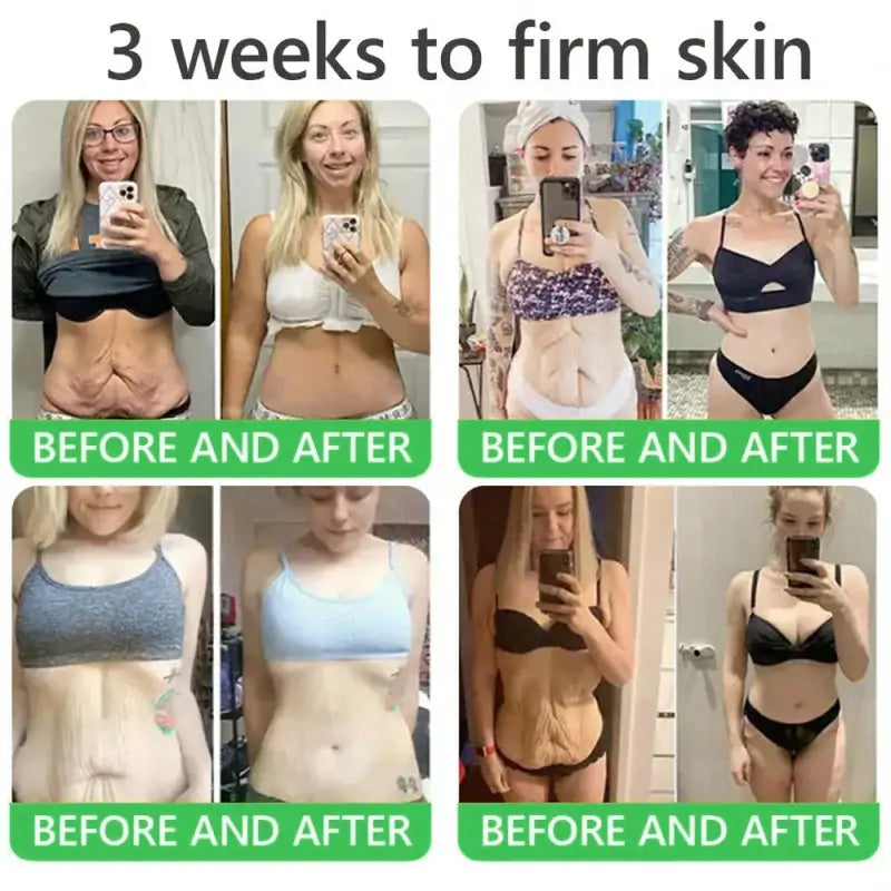 𝐎𝐫𝐢𝐚𝐜𝐡® 𝐀𝟏𝟎+ 𝟔-𝐢-𝐞𝐧 𝐃𝐞𝐫𝐦𝐚𝐑𝐞𝐩𝐚𝐢𝐫 𝐒𝐞𝐫𝐮𝐦 𝐅𝐃𝐀-𝐆𝐨𝐝𝐤𝐣𝐞𝐧𝐭 – Strammer opp slapp hud, reduserer blåmerker og senil purpura, og forbedrer keratinproduksjon, seboreisk dermatitt og follikulær keratose.