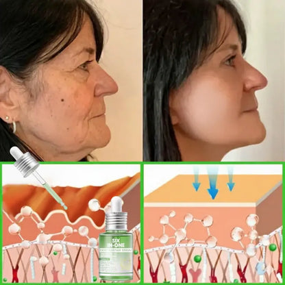 𝐎𝐫𝐢𝐚𝐜𝐡® 𝐀𝟏𝟎+ 𝟔-𝐢-𝐞𝐧 𝐃𝐞𝐫𝐦𝐚𝐑𝐞𝐩𝐚𝐢𝐫 𝐒𝐞𝐫𝐮𝐦 𝐅𝐃𝐀-𝐆𝐨𝐝𝐤𝐣𝐞𝐧𝐭 – Strammer opp slapp hud, reduserer blåmerker og senil purpura, og forbedrer keratinproduksjon, seboreisk dermatitt og follikulær keratose.
