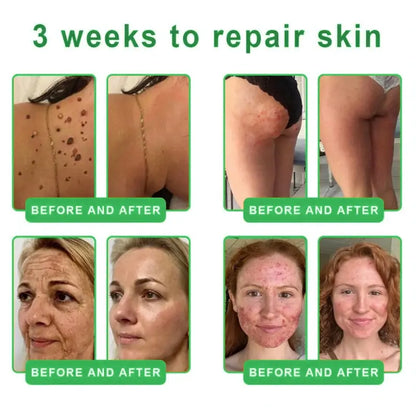 𝐎𝐫𝐢𝐚𝐜𝐡® 𝐀𝟏𝟎+ 𝟔-𝐢-𝐞𝐧 𝐃𝐞𝐫𝐦𝐚𝐑𝐞𝐩𝐚𝐢𝐫 𝐒𝐞𝐫𝐮𝐦 𝐅𝐃𝐀-𝐆𝐨𝐝𝐤𝐣𝐞𝐧𝐭 – Strammer opp slapp hud, reduserer blåmerker og senil purpura, og forbedrer keratinproduksjon, seboreisk dermatitt og follikulær keratose.
