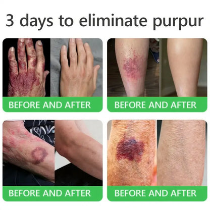 𝐎𝐫𝐢𝐚𝐜𝐡® 𝐀𝟏𝟎+ 𝟔-𝐢-𝐞𝐧 𝐃𝐞𝐫𝐦𝐚𝐑𝐞𝐩𝐚𝐢𝐫 𝐒𝐞𝐫𝐮𝐦 𝐅𝐃𝐀-𝐆𝐨𝐝𝐤𝐣𝐞𝐧𝐭 – Strammer opp slapp hud, reduserer blåmerker og senil purpura, og forbedrer keratinproduksjon, seboreisk dermatitt og follikulær keratose.