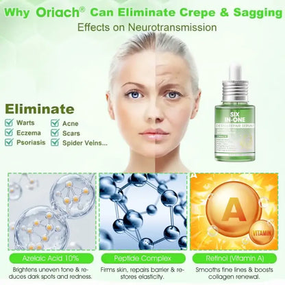 𝐎𝐫𝐢𝐚𝐜𝐡® 𝐀𝟏𝟎+ 𝟔-𝐢-𝐞𝐧 𝐃𝐞𝐫𝐦𝐚𝐑𝐞𝐩𝐚𝐢𝐫 𝐒𝐞𝐫𝐮𝐦 𝐅𝐃𝐀-𝐆𝐨𝐝𝐤𝐣𝐞𝐧𝐭 – Strammer opp slapp hud, reduserer blåmerker og senil purpura, og forbedrer keratinproduksjon, seboreisk dermatitt og follikulær keratose.
