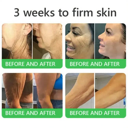 𝐎𝐫𝐢𝐚𝐜𝐡® 𝐀𝟏𝟎+ 𝟔-𝐢-𝐞𝐧 𝐃𝐞𝐫𝐦𝐚𝐑𝐞𝐩𝐚𝐢𝐫 𝐒𝐞𝐫𝐮𝐦 𝐅𝐃𝐀-𝐆𝐨𝐝𝐤𝐣𝐞𝐧𝐭 – Strammer opp slapp hud, reduserer blåmerker og senil purpura, og forbedrer keratinproduksjon, seboreisk dermatitt og follikulær keratose.