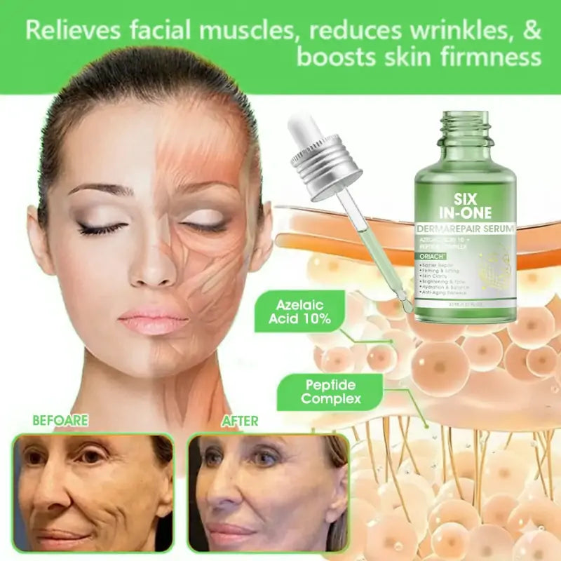 𝐎𝐫𝐢𝐚𝐜𝐡® 𝐀𝟏𝟎+ 𝟔-𝐢-𝐞𝐧 𝐃𝐞𝐫𝐦𝐚𝐑𝐞𝐩𝐚𝐢𝐫 𝐒𝐞𝐫𝐮𝐦 𝐅𝐃𝐀-𝐆𝐨𝐝𝐤𝐣𝐞𝐧𝐭 – Strammer opp slapp hud, reduserer blåmerker og senil purpura, og forbedrer keratinproduksjon, seboreisk dermatitt og follikulær keratose.