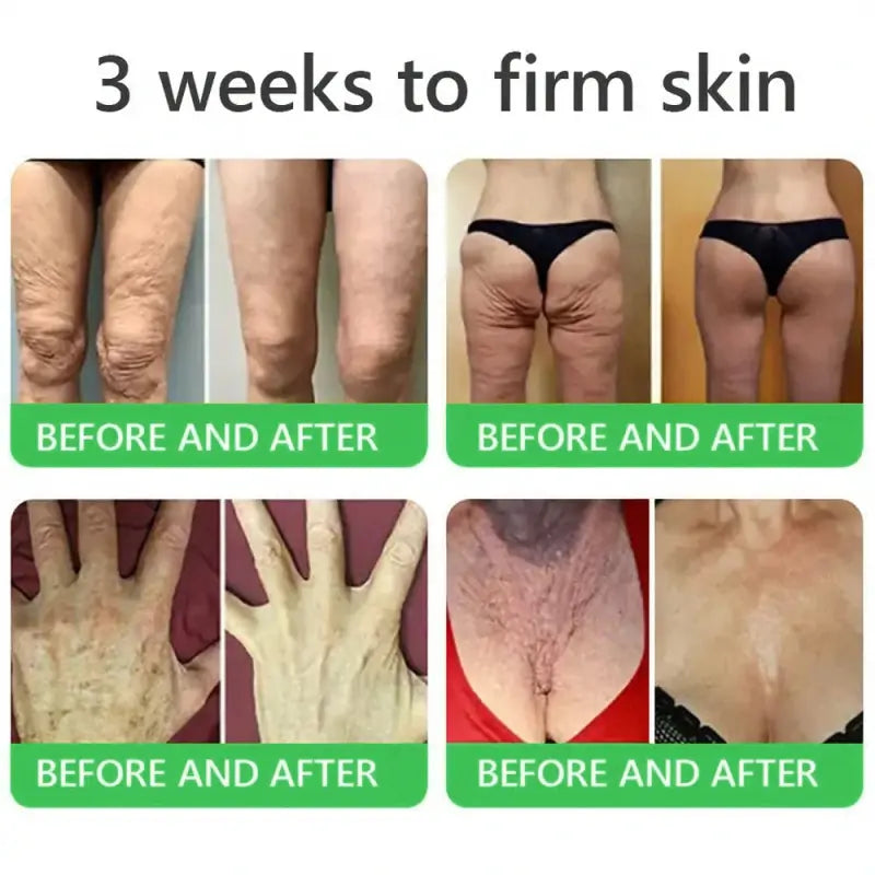 𝐎𝐫𝐢𝐚𝐜𝐡® 𝐀𝟏𝟎+ 𝟔-𝐢-𝐞𝐧 𝐃𝐞𝐫𝐦𝐚𝐑𝐞𝐩𝐚𝐢𝐫 𝐒𝐞𝐫𝐮𝐦 𝐅𝐃𝐀-𝐆𝐨𝐝𝐤𝐣𝐞𝐧𝐭 – Strammer opp slapp hud, reduserer blåmerker og senil purpura, og forbedrer keratinproduksjon, seboreisk dermatitt og follikulær keratose.