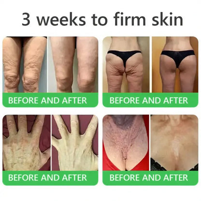 𝐎𝐫𝐢𝐚𝐜𝐡® 𝐀𝟏𝟎+ 𝟔-𝐢-𝐞𝐧 𝐃𝐞𝐫𝐦𝐚𝐑𝐞𝐩𝐚𝐢𝐫 𝐒𝐞𝐫𝐮𝐦 𝐅𝐃𝐀-𝐆𝐨𝐝𝐤𝐣𝐞𝐧𝐭 – Strammer opp slapp hud, reduserer blåmerker og senil purpura, og forbedrer keratinproduksjon, seboreisk dermatitt og follikulær keratose.